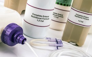 Sondevoeding - kopie