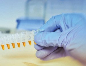Biomarker
